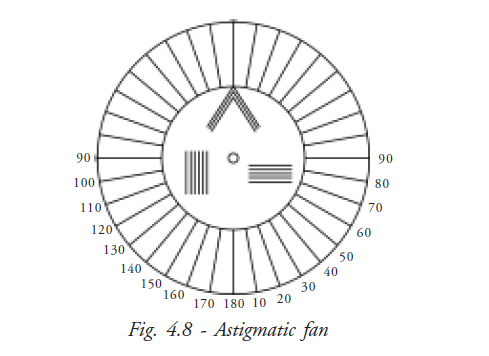  Simple Astigmatism 