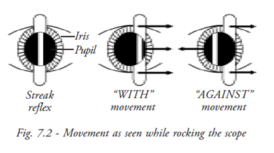 Movement on the retinoscope