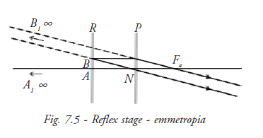 Reflex Stage Emmetropia