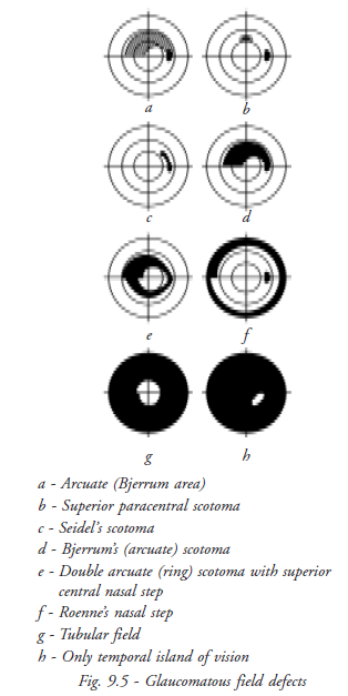  Glaucomatous Field Defects 
